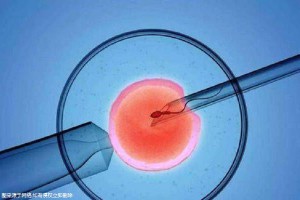安孕冻胚移植专科